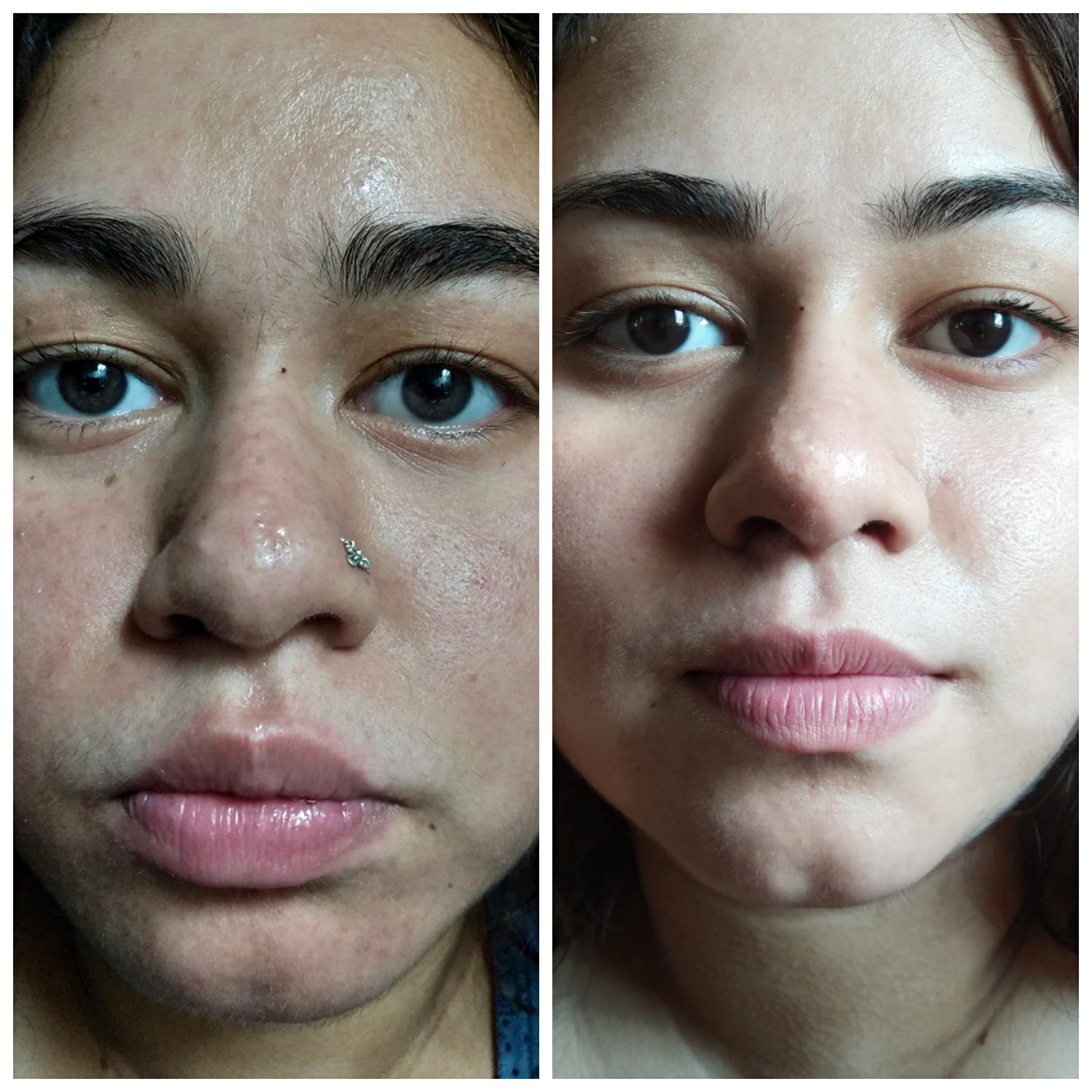 Antes y después — Sandra