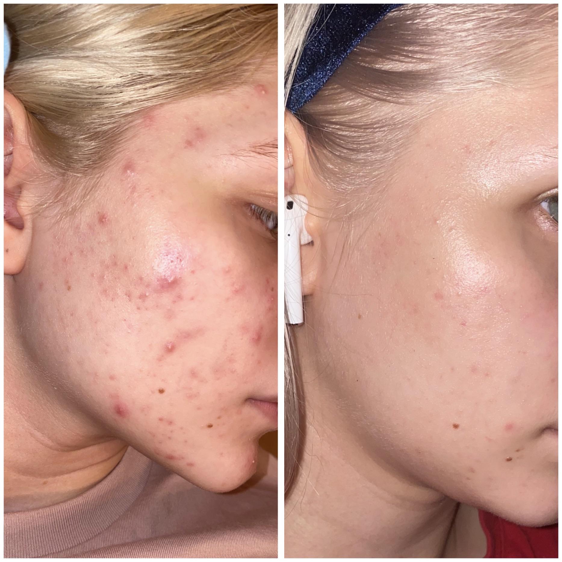 Antes y después — Marcela