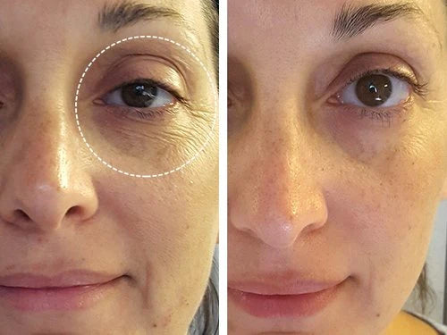 Antes y después — Andrea