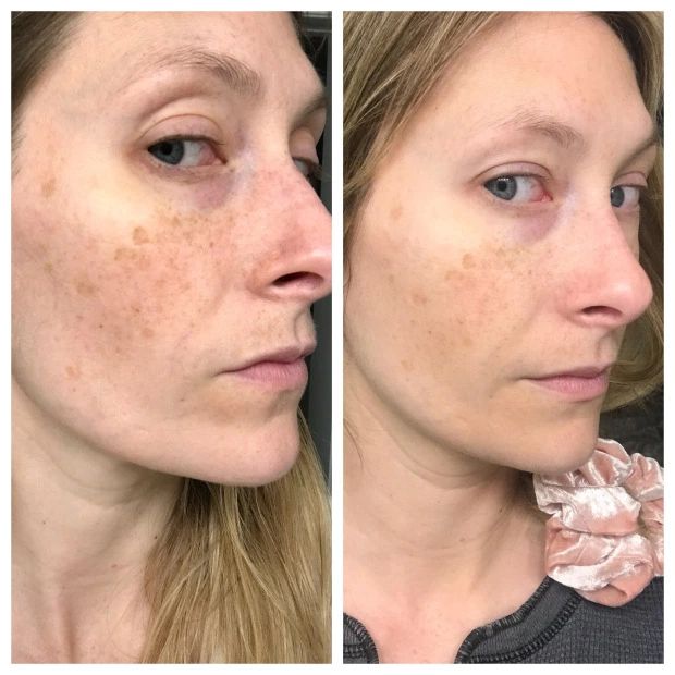 Antes y después — Diana
